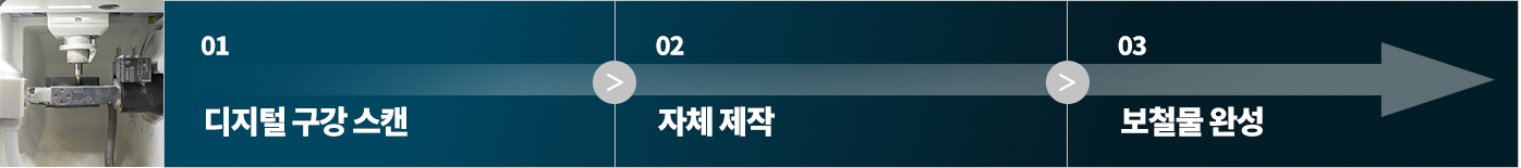 자체 원내 기공소 단계
