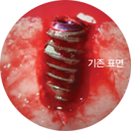 기존 표면