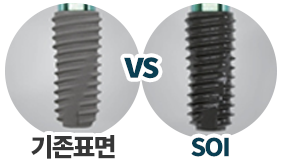 골 형성 촉진 표면 비교