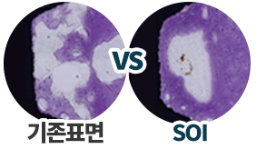 치료기간 단축 비교